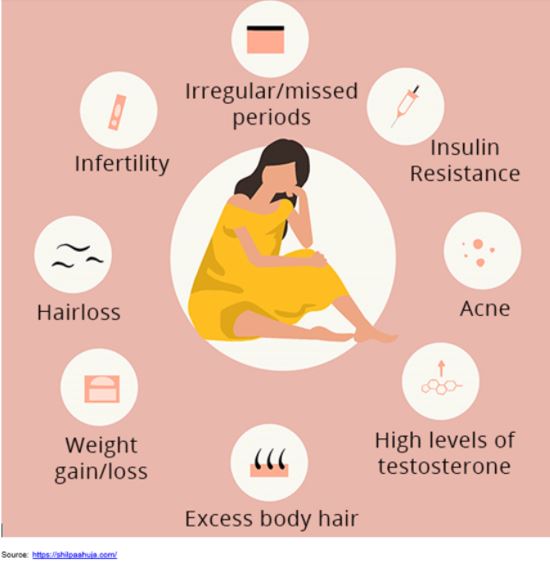 Polycystic Ovary Syndrome